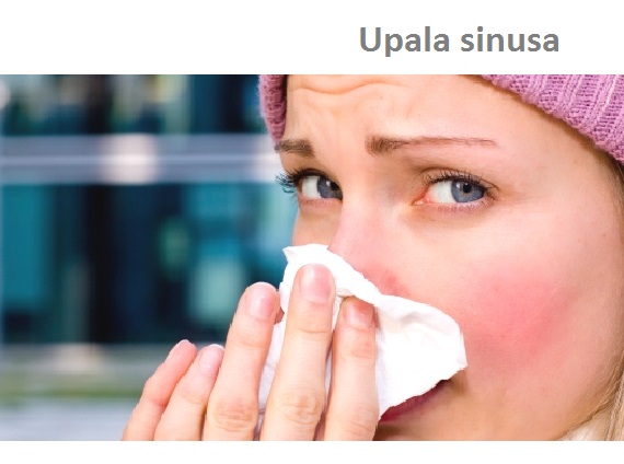 Sinuzitis